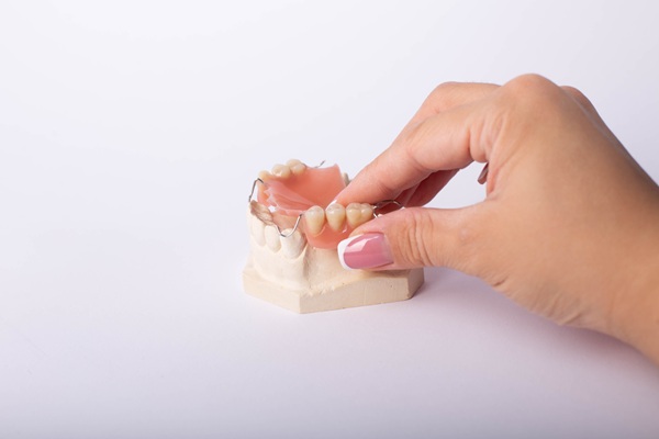 What Causes Dental Bridge Failure?