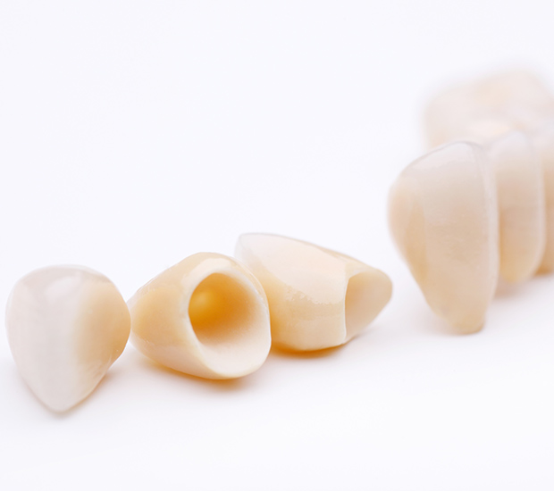 Scottsdale Dental Crowns and Dental Bridges