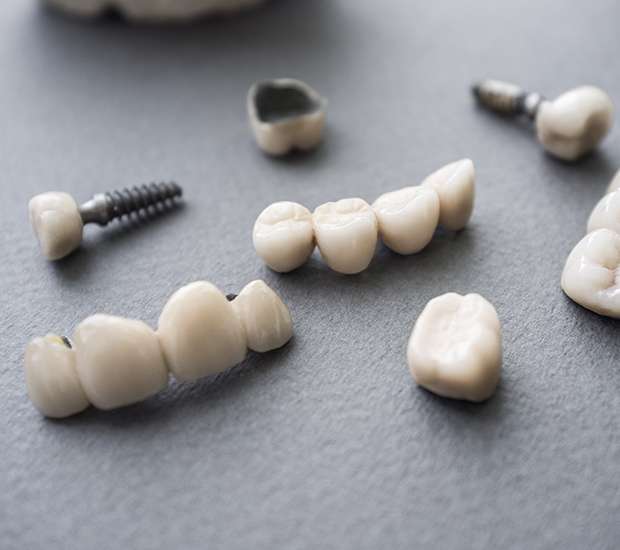 Scottsdale The Difference Between Dental Implants and Mini Dental Implants