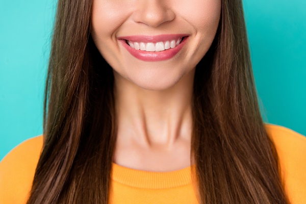 Dental Bonding Vs Fillings For A Smile Makeover